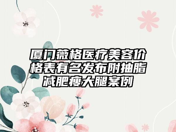 厦门薇格医疗美容价格表有名发布附抽脂减肥瘦大腿案例