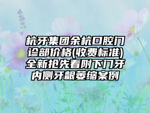 杭牙集团余杭口腔门诊部价格(收费标准)全新抢先看附下门牙内侧牙龈萎缩案例