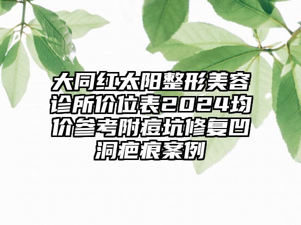 大同红太阳整形美容诊所价位表2024均价参考附痘坑修复凹洞疤痕案例