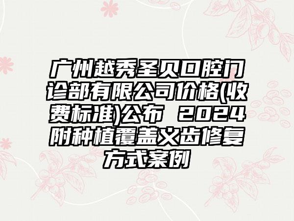 广州越秀圣贝口腔门诊部有限公司价格(收费标准)公布 2024附种植覆盖义齿修复方式案例