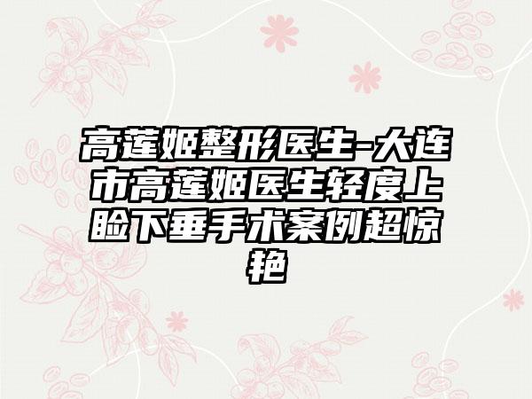 高莲姬整形医生-大连市高莲姬医生轻度上睑下垂手术案例超惊艳