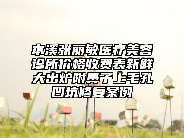 本溪张丽敏医疗美容诊所价格收费表新鲜大出炉附鼻子上毛孔凹坑修复案例