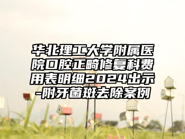 华北理工大学附属医院口腔正畸修复科费用表明细2024出示-附牙菌斑去除案例