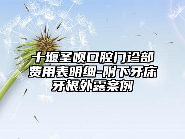 十堰圣呗口腔门诊部费用表明细-附下牙床牙根外露案例