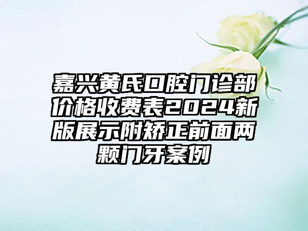 嘉兴黄氏口腔门诊部价格收费表2024新版展示附矫正前面两颗门牙案例