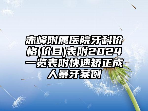 赤峰附属医院牙科价格(价目)表附2024一览表附快速矫正成人暴牙案例