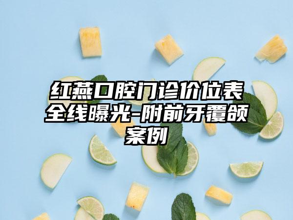 红燕口腔门诊价位表全线曝光-附前牙覆颌案例